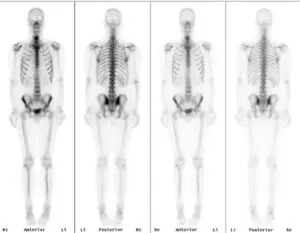botscan onderzoek